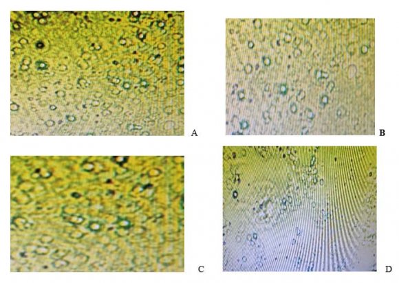 TPN2 PN3 TPN3 PN4 TPN4 PN5 TPN5 PN6 TPN6 PN7 TPN7 PN8 TPN8 Comparative invitro drug release profile of Normal patches with transferosomal patches % Drug release of normal patches %Drug release of transferosomal patches In-vitro evaluation of transdermal patch with nebivolol hydrochloride nanocarriers using pig skin