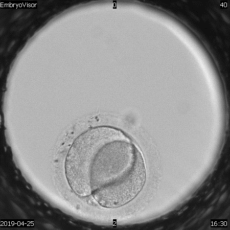 high. Attention should be paid to this group and a more rigorous selection of embryos for transfer should be carried out, while at the same time reducing the number of transferred embryos.