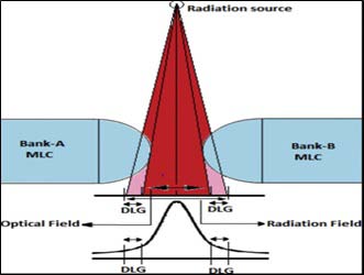 Figure 1: Transmission through the rounded-end of MLC leaf illustrating that both the optical field size and DLG constitute a radiation field [10].