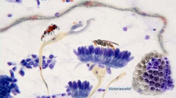 Figure 1: Facial malar rash