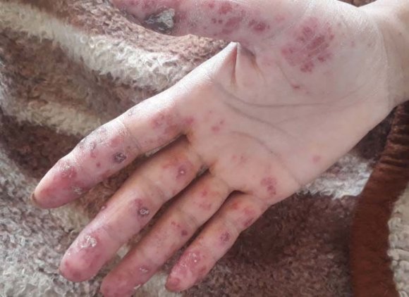 Fig. 2: The measured positive effect (higher energy and better balance) of positive thinking on our health Since clockwise spinning of dancing partners has the same uplifting effect on both dancing partners as the effect of positive emotions (or just positive thinking), we can expect dancing with clockwise spinning to have the same positive effect on the health of the dancing partners as positive emotions (or just positive thinking).