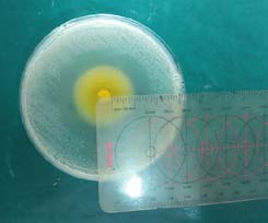 Fig.1: Zone of inhibition measured for TAP (saline), TAP (Chlorhexidine), Calcium hydroxide (saline) and Calcium hydroxide (Chlorhexidine)