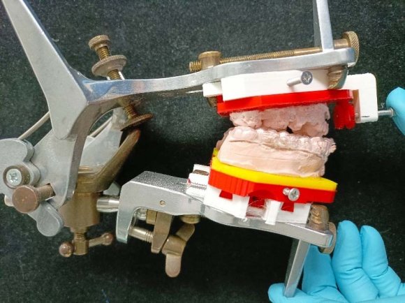 Fig. 6: Ideal Smile should show sufficient discovery at rest