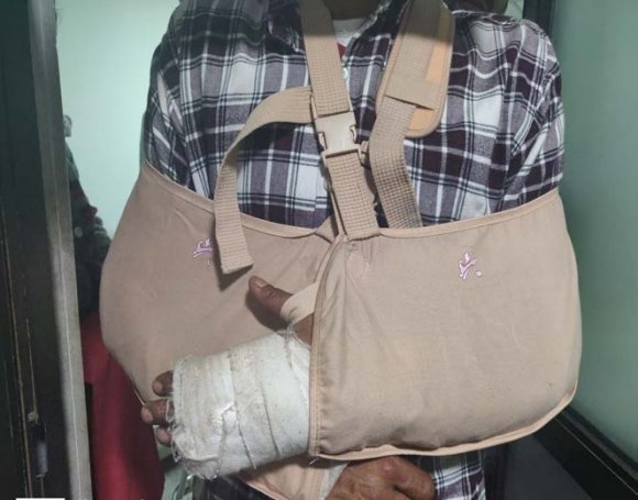 Figure 2: Photo showing facial injury