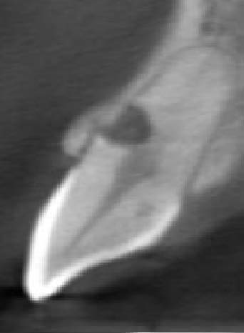 Protective Effect of Different Extracts of Celtis Australis and Syzygium Aromaticum on Tetrahymena for the Cytotoxicity of Nickel-Titanium-Based Orthodontic Wires Pre-culture of artificial saliva Artificial saliva + wires (NiTi or CuNiTi)