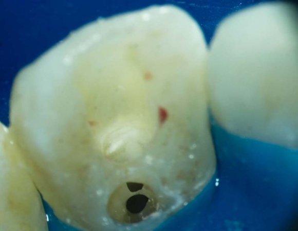 Figure 3: Evolution of the growth of Tetrahymena thermophila and Tetrahymena pyriformis in artificial saliva (S.A) and the PPYE medium. There is no statistically significant difference between the two environments.
