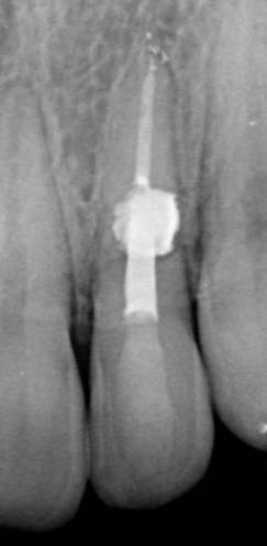 Figure 9: Effect of different types of Syzygium aromaticum (clove) extracts on the cytotoxicity of NiTi and CuNiTi arcs on Tetrahymena during 7 days of culture. Absorbance was determined at 600nm every 24 hours of growth. A.S: