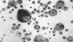 Fig.12(a): Setor de peneiramento e aglutinação e; (b) Processo de prensagem com matriz móvel. e (c). Montagem da matriz de compactação móvel. Após a etapa de compactação, os compactados a verde, Fig.13(a) seguem para o setor de pré-sinterização e continuam o processo, sendo colocados em caçambas de grafite Fig.13 (b) e depois colocados em um forno com atmosfera de hidrogênio a temperaturas que podem variar de 750 de até 1000 ºC. Essa etapa consiste na remoção do aglutinante (parafina ou hexano ou MEG ou PEG), a fim de obter propriedades de resistências à ruptura para facilitar na próxima etapa, chamada de pré-usinagem. Nesta etapa o trabalhador encontrou-se exposto aos agentes nocivos: inalação de pó de grafite, fumos, óxidos e gases tóxicos proveniente da eliminação do aglutinante, riscos de incêndio ou até explosão conforme relatos dos trabalhadores.