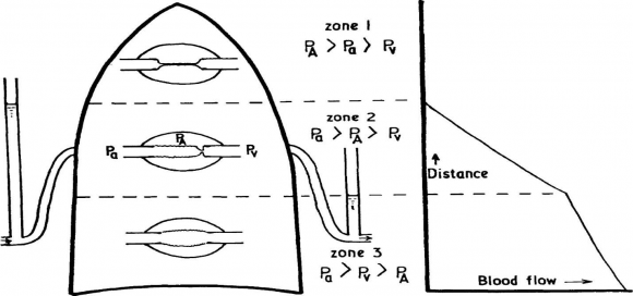 Assessment of Prone Position in Severe Acute Respiratory Syndrome