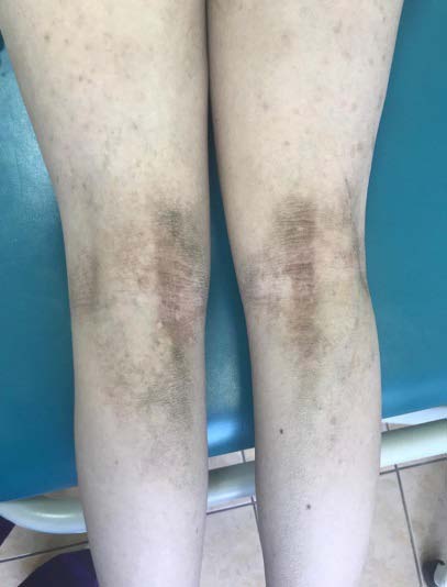 Fig. 4: Before surgery: rear view and lateral view.