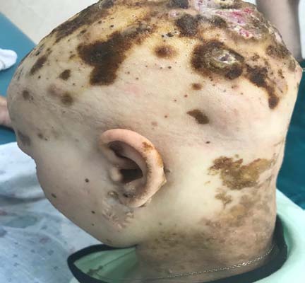 by an ophthalmologist, an otolaryngologist, and a pediatric surgeon